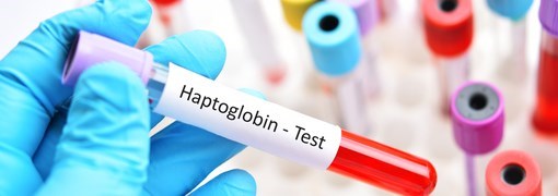 בדיקת הפטוגלובין Haptoglobin - תמונה